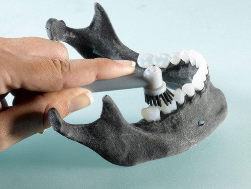 3D打印帮助牙医给患者带来完美的空腔